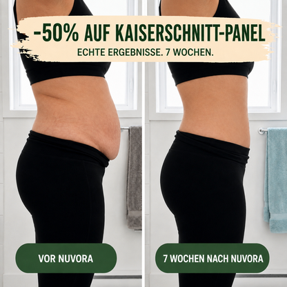 Postpartum-Shaping-Slip – 360°-Kompression