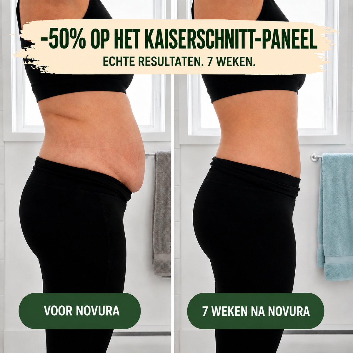 Postpartum-shaping-slip – 360°-compressie