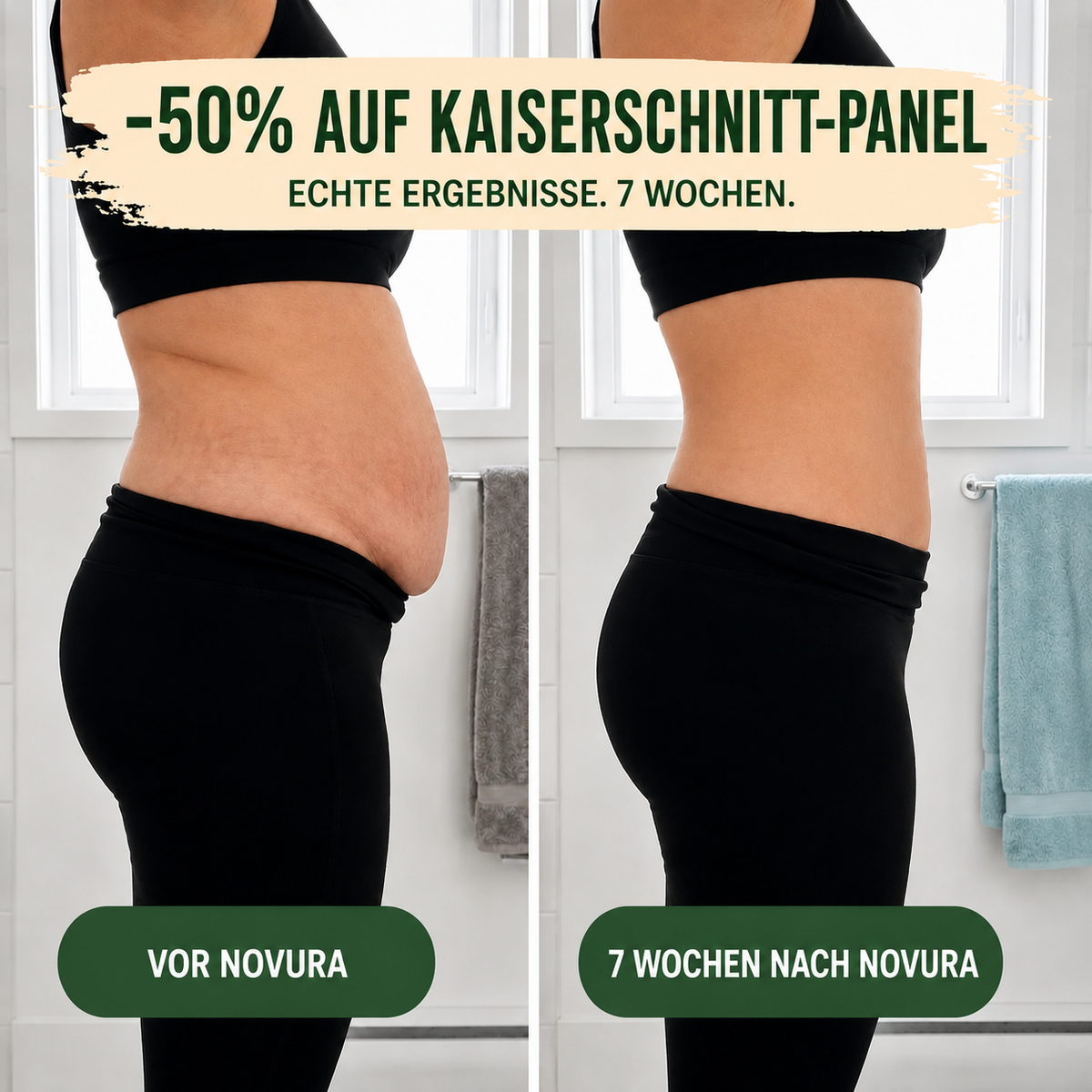 Postpartum-Shaping-Slip – 360°-Kompression